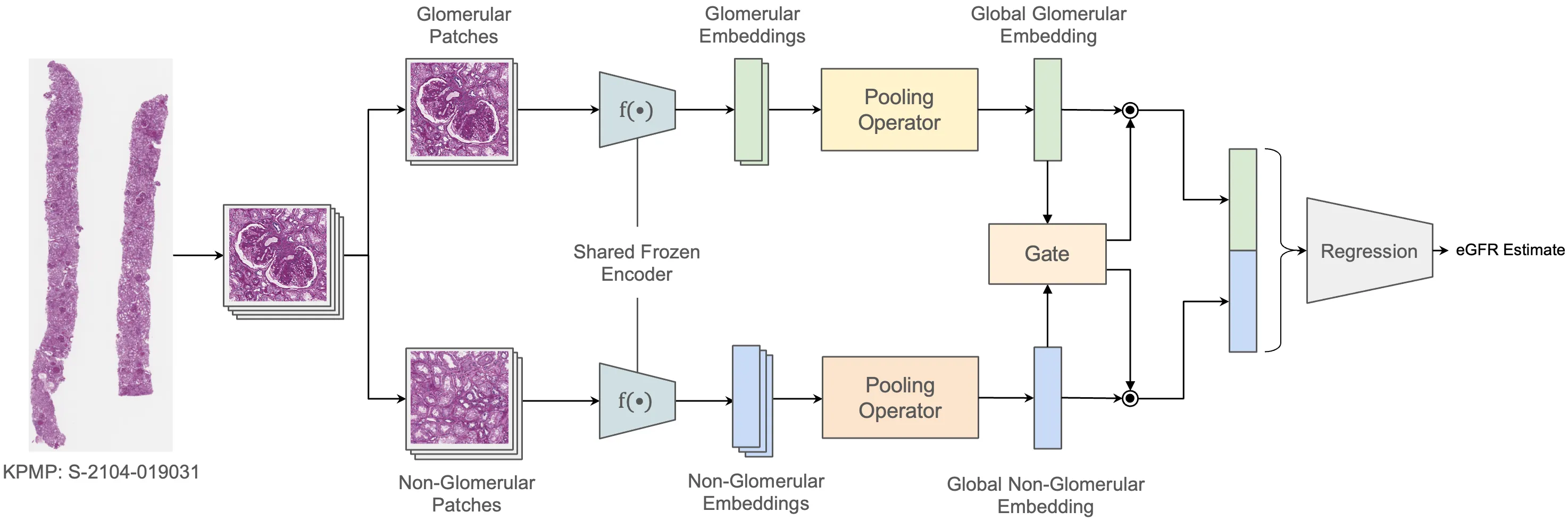AC-MIL architecture: kidney tissue patches are separated into glomerular and non-glomerular streams, embedded and pooled independently, then combined through bidirectional gates for eGFR prediction.